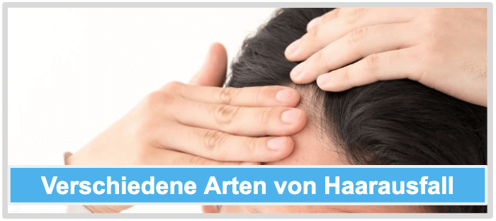 Haarwuchsmittel Verschiedene Arten von Haarausfall