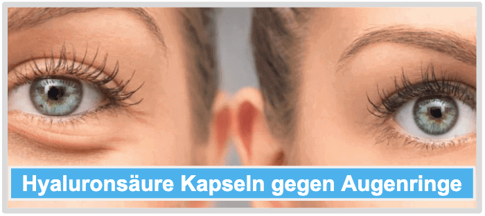 Hyaluronsäure Kapseln Augenringe Anwendungsgebiete