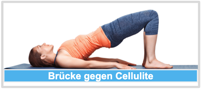 Brücke gegen Cellulite