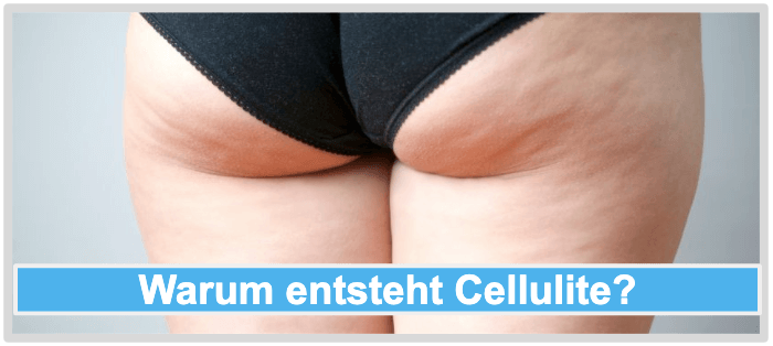 Warum entsteht Cellulite