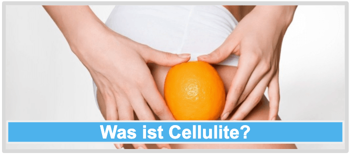Was ist Cellulite