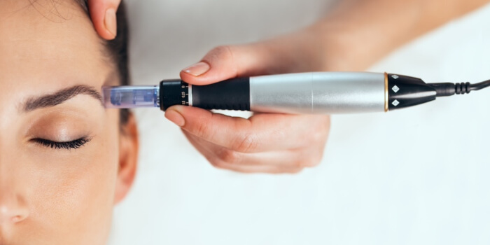 Dermaroller Microneedling zuhause
